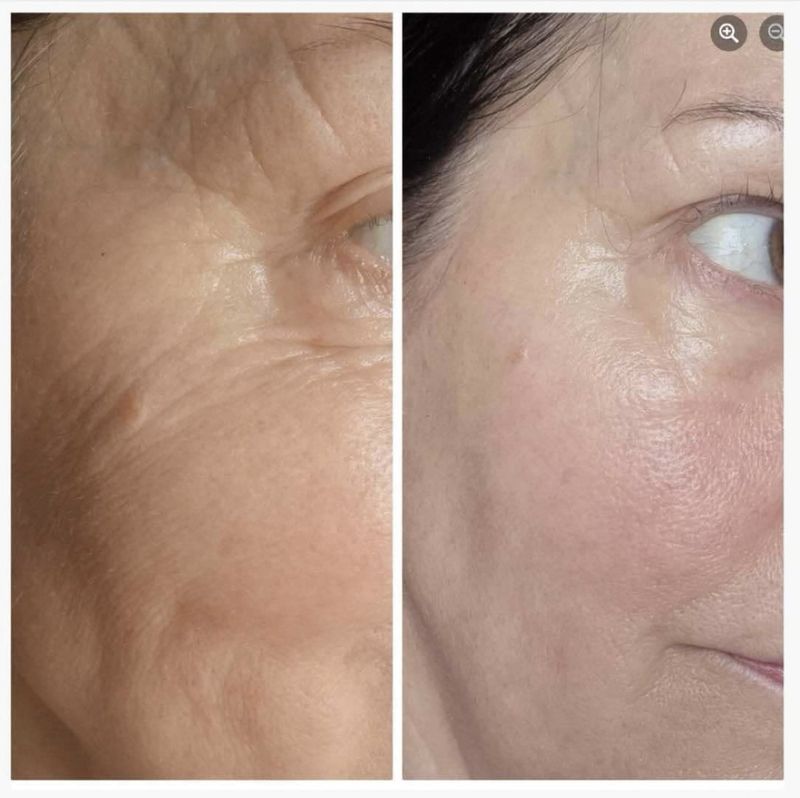 Collagen Boozt