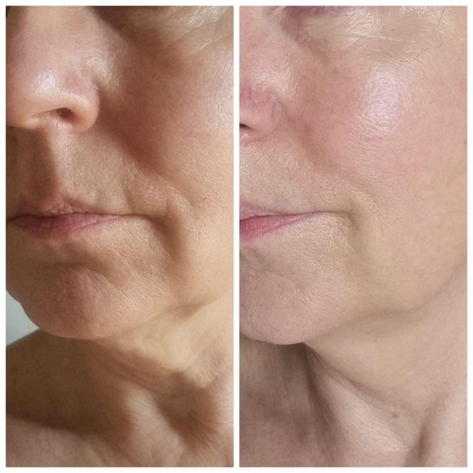 Hovedbilde Collagen Boozt